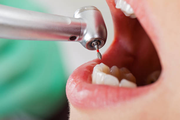 Best Cosmetic Emergency Dentistry in Creston, OH